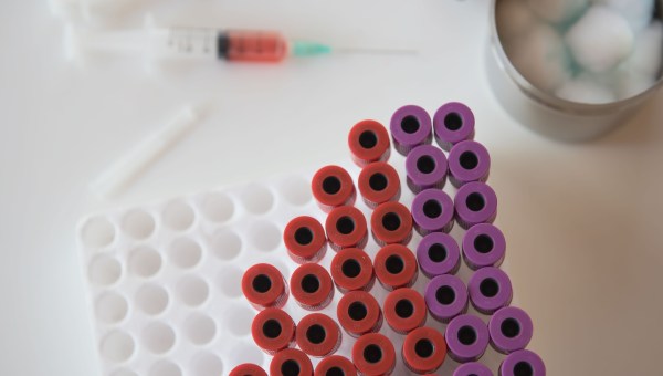 Don du sang : tout ce qu’il faut savoir avant d'y aller