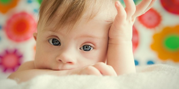 ENFANT ; BEBE ; SYNDROME DE DOWN
