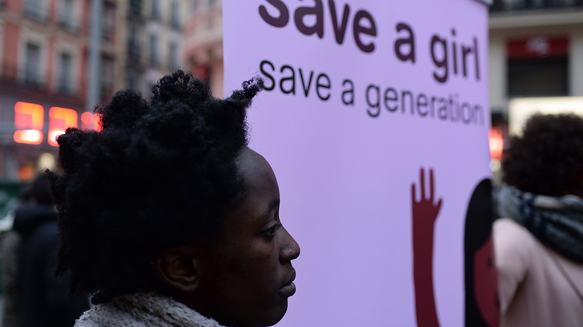 FGM