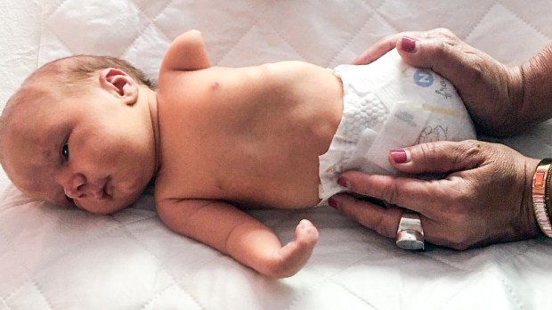 Apres La Naissance De Son Bebe Sans Membres Une Maman A Ete Temoin D Un Miracle Apres La Naissance De Son Bebe Sans Membres Une Maman A Ete Temoin D Un Miracle