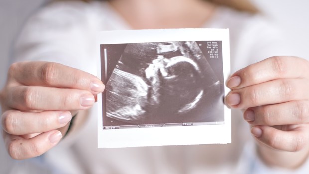 WOMAN,HANDS,ULTRASOUND,BABY,PREGNANT