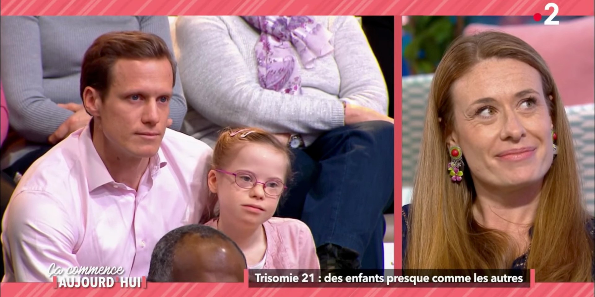 DOWN SYNDROME