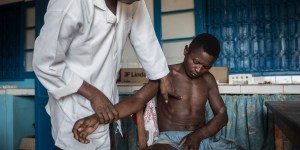 La lutte contre la lèpre, un combat qui ne faiblit pas