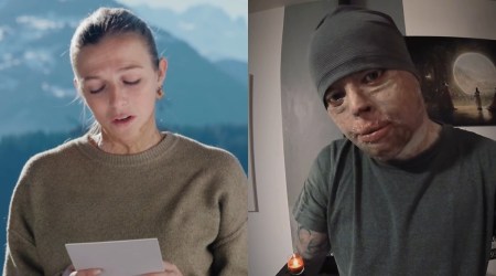 “Un jour, la vie reviendra” : après Crans Montana, les témoignages de grands brûlés