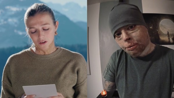 Corner Item Image - “Un jour, la vie reviendra” : après Crans Montana, les témoignages de grands brûlés